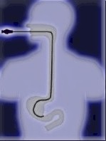 Click here for Gastroscopes!