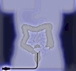 Click here for Sigmoidoscopes!